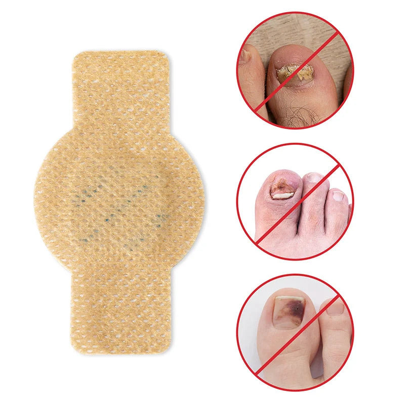 1+1 GRATIS | NagelClear Patch – Starke Nägel ohne Pilzinfektion