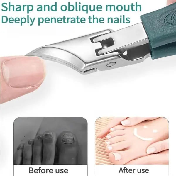 NailCut™ – Präzise Pflege für Problemnägel