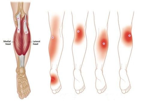 WärmeFlex Kniebandage — Schnelle Schmerzlinderung durch natürliche Wärme