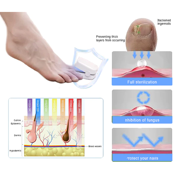 NailClear Pro – Gesunde Nägel durch sanfte Lichttherapie