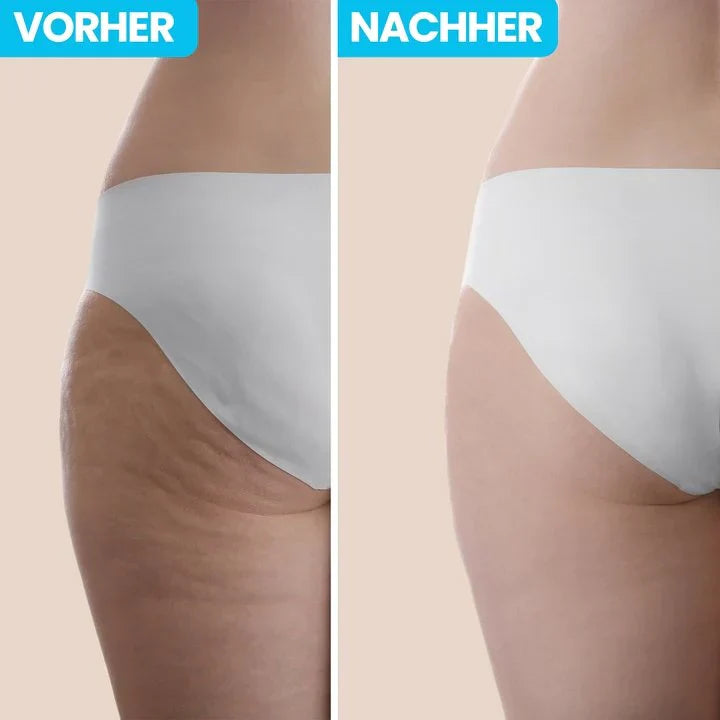 CelluPro™ – Glatte Haut in nur wenigen Minuten täglich
