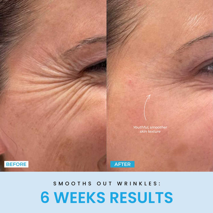 LiftGlow – Dein 5-Minuten-Facelifting für Zuhause