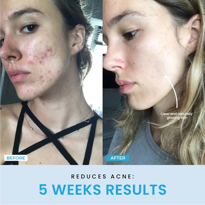 LiftGlow – Dein 5-Minuten-Facelifting für Zuhause