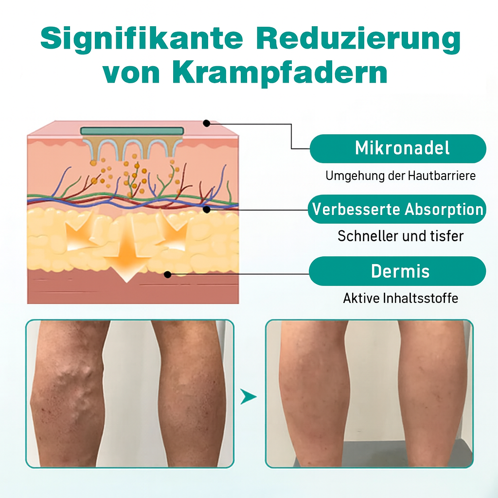 VenoLift Patch – Schluss mit schmerzhaften, sichtbaren Venen
