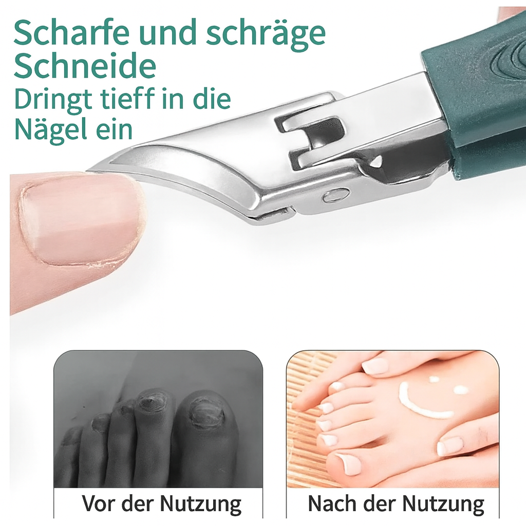 NailCut™ – Präzise Pflege für Problemnägel