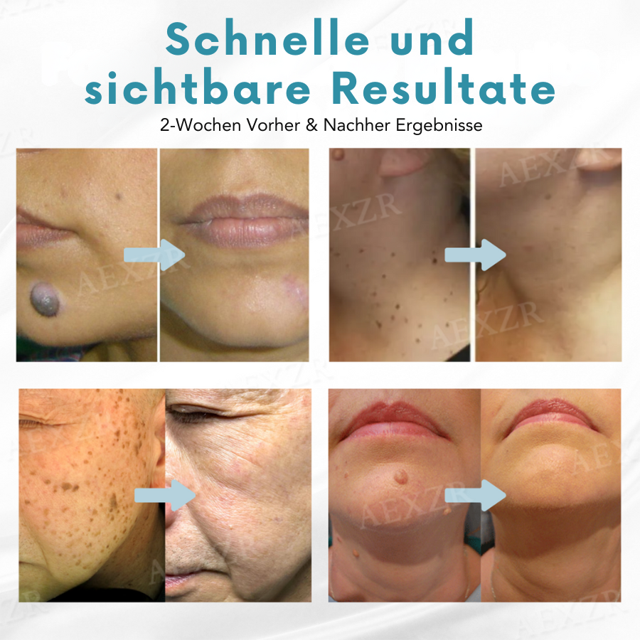 Radiant™ – Schnelle Hautverjüngung in Profi-Qualität [1+1 GRATIS]