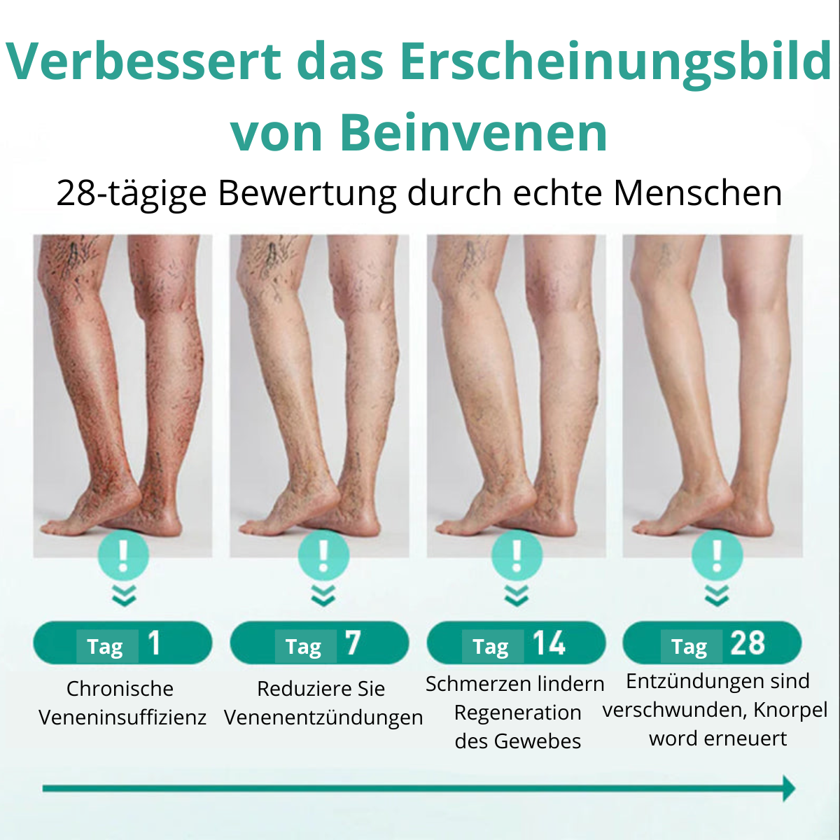 VenoLift Patch – Schluss mit schmerzhaften, sichtbaren Venen
