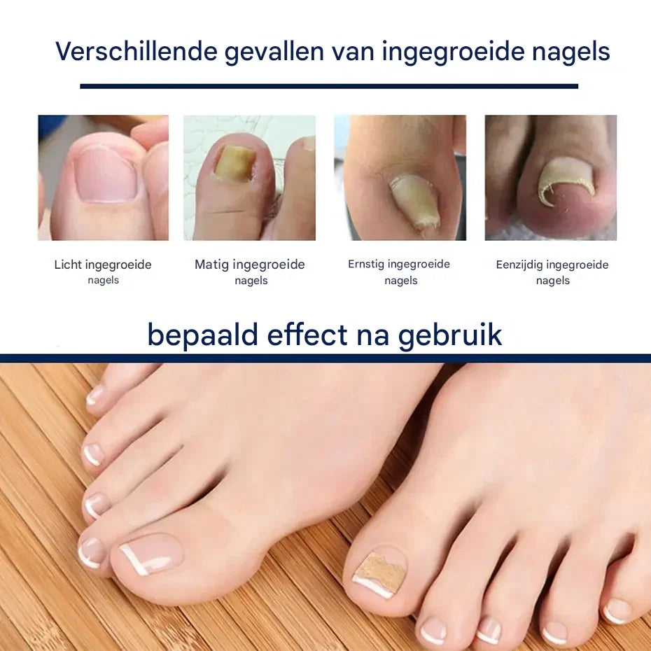 NailCareLift – Für makellose, gesunde Nägel