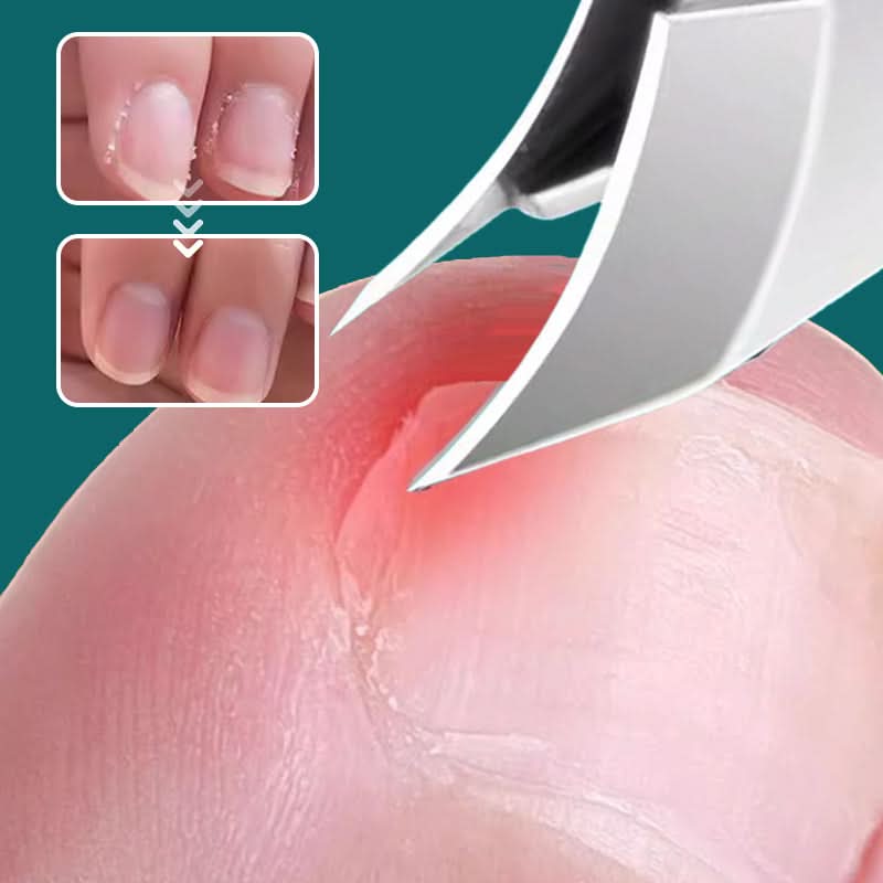 NailCarePro – Saubere Nägel ohne Unordnung